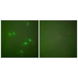 Tumor Suppressor ARF (CDKN2A) Antibody