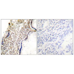 Tumor Suppressor ARF (CDKN2A) Antibody