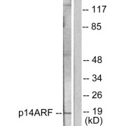 Western blot analysis of extracts from HeLa cells, using p14 ARF antibody (abx013162).