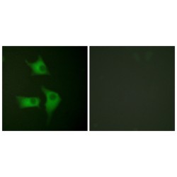 p15 INK Antibody