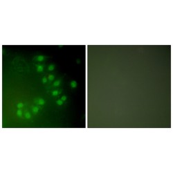 Tumor Protein P63 (TP63) Antibody