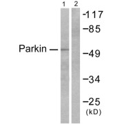 Western blot analysis of extracts from Jukat cells, using Parkin antibody. The lane on the right is blocked with the synthesized peptide.