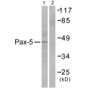 Western blot analysis of extracts from 293 cells, using Pax-5 antibody (abx013173).