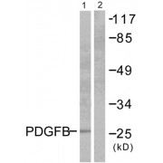Western blot analysis of extracts from NIH/3T3 cells, using PDGFB antibody (abx013175).