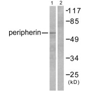 Western blot analysis of extracts from HepG2 cells, using Peripherin antibody. The lane on the right is blocked with the synthesized peptide.