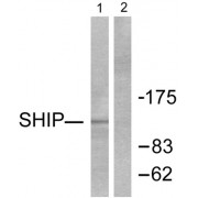 Western blot analysis of extracts from Jurkat cells, treated with PMA (1ng/ml, 15mins), using SHIP antibody (abx013191).