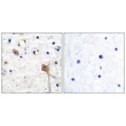 Tyrosine-Protein Phosphatase Non-Receptor Type 11 (SH-PTP2) Antibody