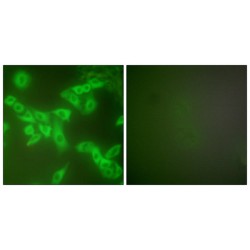 Stefin B (STFB) Antibody