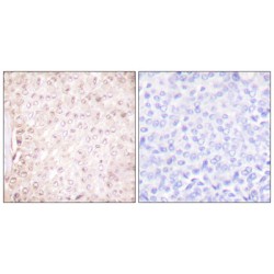 Stefin B (STFB) Antibody