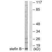 Western blot analysis of extracts from A549 cells, using Stefin B antibody (abx013197).