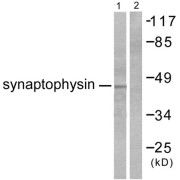 Western blot analysis of extracts from LOVO cells, using Synaptophysin (SYP) Antibody.