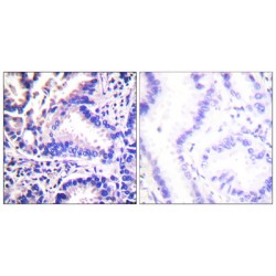 Synuclein Gamma (SNCG) Antibody