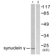 Western blot analysis of extracts from HT29 cells, using Synuclein gamma Antibody (abx013200).