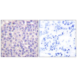 Transforming Growth Factor Beta-3 (TGFB3) Antibody