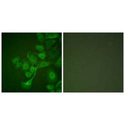 Metalloproteinase Inhibitor 2 (TIMP2) Antibody