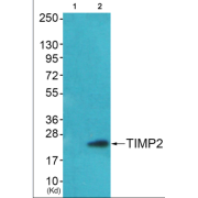 Western blot analysis of extracts from HepG2 cells (Lane 2), using TIMP2 Antibody. The lane on the left is treated with systhesized peptide.