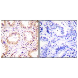 Neural Precursor Cell Expressed, Developmentally Down-Regulated 8 (NEDD8) Antibody