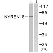 Western blot analysis of extracts from COS7 cells, using NYREN18 antibody.