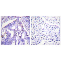 Protein Inhibitor of Activated STAT4 (PIAS4) Antibody