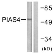 Western blot analysis of extracts from Jurkat cells, using PIAS4 antibody.