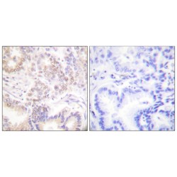 SUMO1/Sentrin Specific Peptidase 5 (SENP5) Antibody