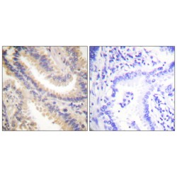 Metalloproteinase Inhibitor 4 (TIMP4) Antibody