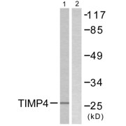 Western blot analysis of extracts from NIH/3T3 cells, using TIMP4 antibody.