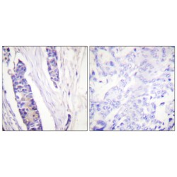 Tubulin Beta (TUBB) Antibody