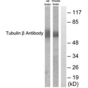 Western blot analysis of extracts from rat brain and mouse brain cells, using Tubulin beta antibody.