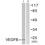 Western blot analysis of extracts from Jurkat cells, using VEGFB antibody.