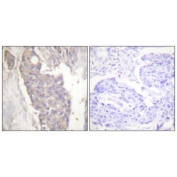 TNF Receptor Superfamily Member 6 / CD95 / TNFRSF6 (FAS) Antibody