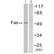 Western blot analysis of extracts from LOVO cells, using Fas antibody.