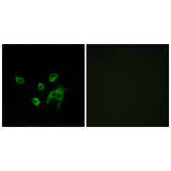 Proto-Oncogene Wnt-1 (WNT1) Antibody
