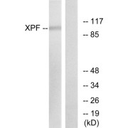 Western blot analysis of extracts from 293 cells, using XPF antibody.