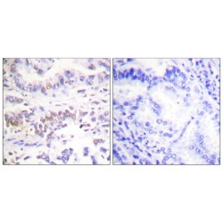 X-Ray Repair Cross Complementing 3 (XRCC3) Antibody