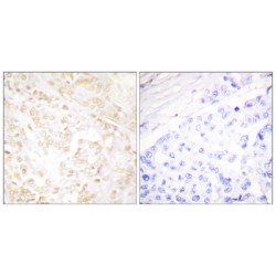 X-Ray Repair Cross Complementing 6 (XRCC6) Antibody
