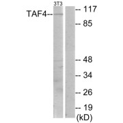 Western blot analysis of extracts from NIH-3T3 cells, using TAF4 antibody.