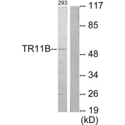 Western blot analysis of extracts from 293 cells, using TR11B antibody.