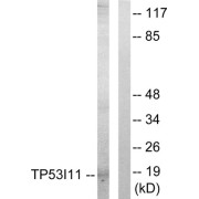 Western blot analysis of extracts from HUVEC cells, using TP53I11 antibody.