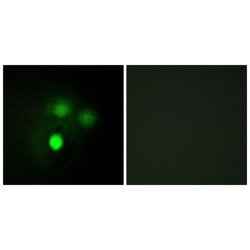 Kinetochore-Associated Protein 2 (KNTC2) Antibody