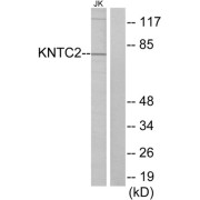 Western blot analysis of extracts from Jurkat cells, using KNTC2 antibody.