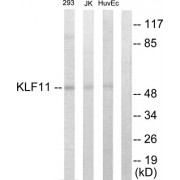 Western blot analysis of extracts from 293 cells, Jurkat cells and HuvEc cells, using KLF11 antibody.