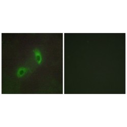 Hepatocyte Growth Factor-Regulated Tyrosine Kinase Substrate (HGS) Antibody