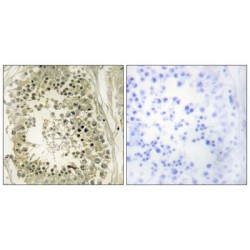 Hepatocyte Growth Factor-Regulated Tyrosine Kinase Substrate (HGS) Antibody