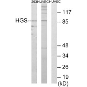 Western blot analysis of extracts from 293 cells and HUVEC cells, using HGS antibody.