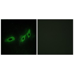 Tripartite Motif-Containing Protein 18 (TRI18) Antibody