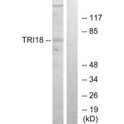 Western blot analysis of extracts from 293 cells, using TRI18 antibody.