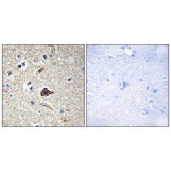 Tumor Necrosis Factor Ligand Superfamily Member 12 (TNF12) Antibody