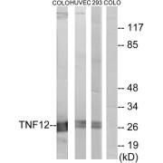 Western blot analysis of extracts from COLO cells, HUVEC cells and 293 cells, using TNF12 antibody.