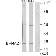 Western blot analysis of extracts from COLO205 cells and HeLa cells, using EFNA2 antibody.